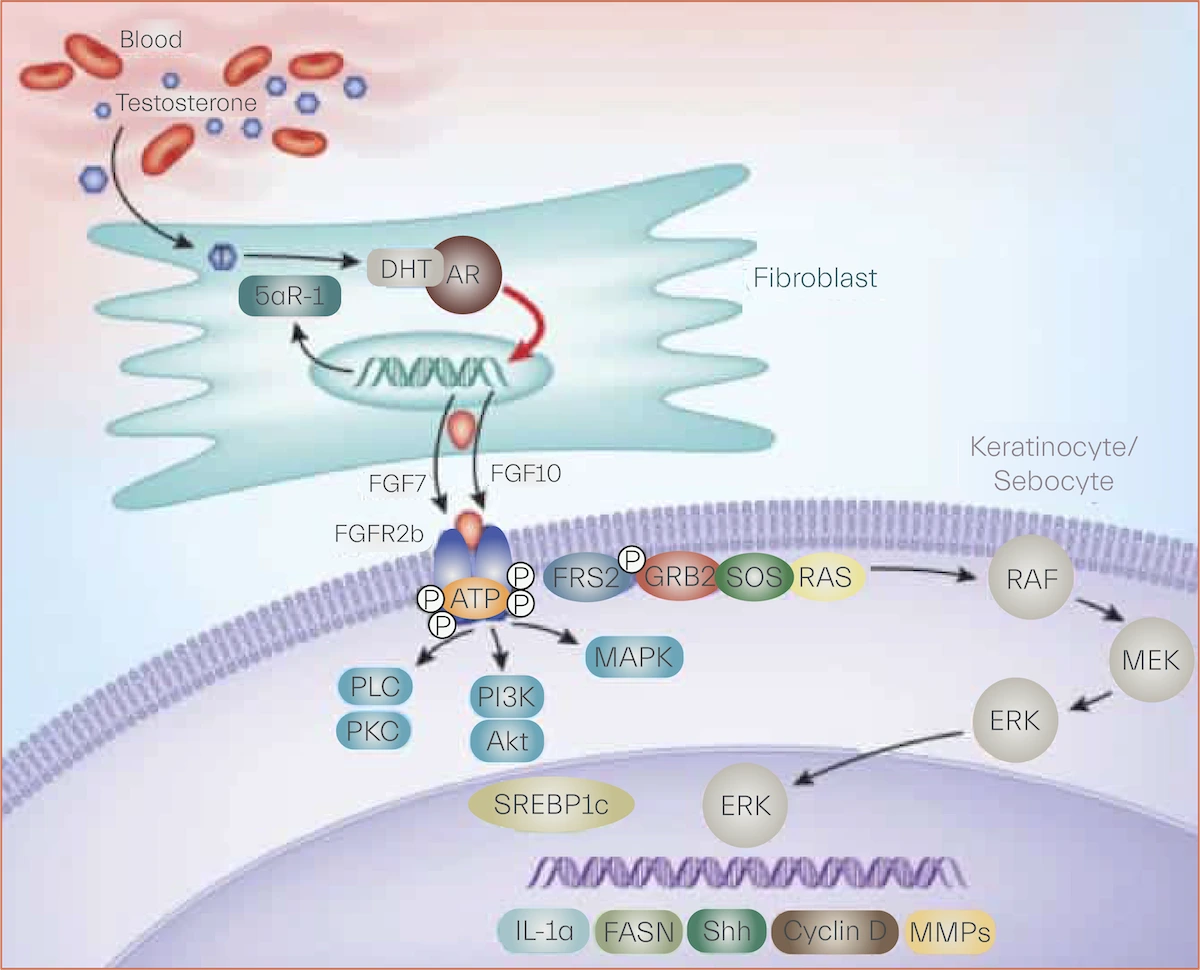 - Fibroblast growth factor receptor signaling in pathogenesis of acne vulgaris