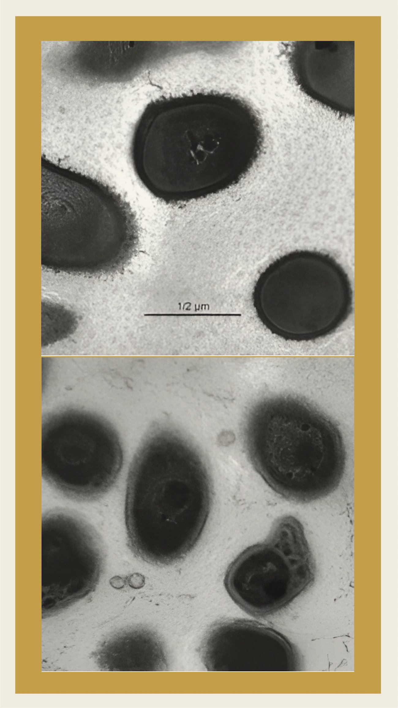 - Transformation in bacterial structures under effect of resveratrol